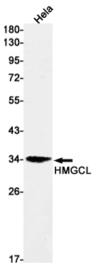 HMGCL Rabbit mAb[52339]