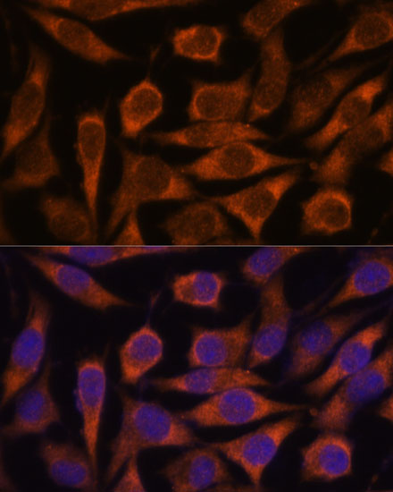 ME3 Rabbit Polyclonal Antibody