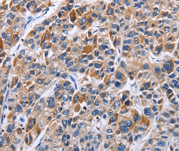 ENPP5 Antibody[35725]