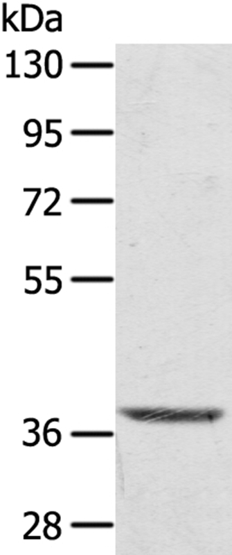 TBC1D21 Antibody[40238]