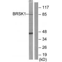 BRSK1 Antibody[33989]