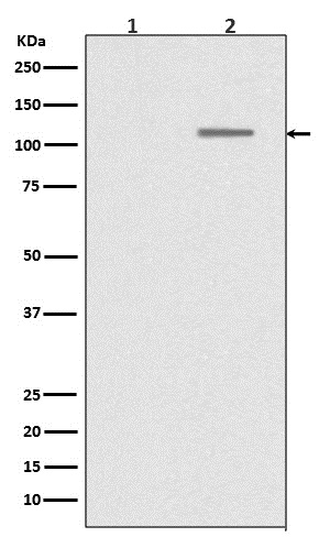 SIRT1 (Phospho-Ser47) Rabbit m