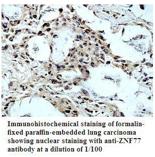ZNF77 Antibody[39797]