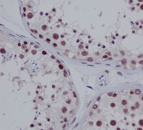 PIAS1 + PIAS2 Rabbit mAb[56171
