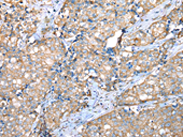 VAPA Antibody[42826]