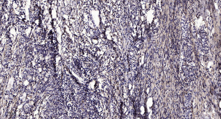 PLCγ2 (phospho-Tyr759) rabbit 