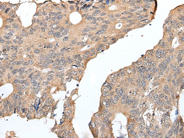 SEPW1 Antibody[43935]