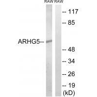 ARHGEF5 Antibody[34996]