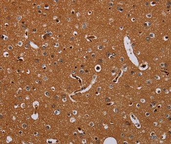 KLK13 Antibody[36578]