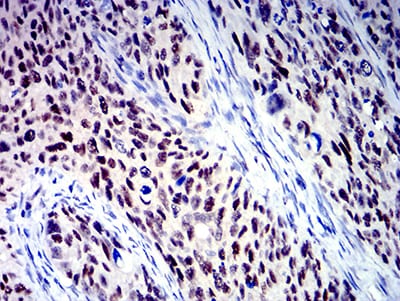 BCL9L Mouse mAb[63144]