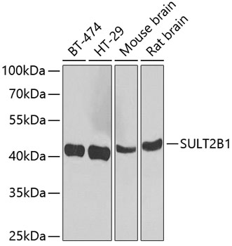 SULT2B1 Rabbit Polyclonal Anti