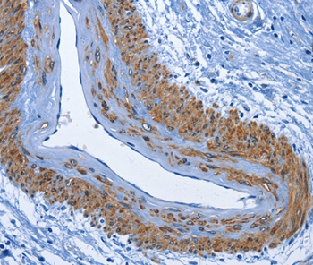 CD177 Antibody[36325]