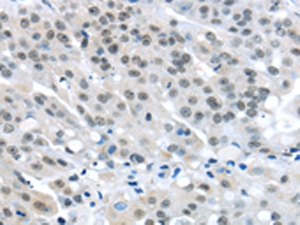MED4 Antibody[43340]