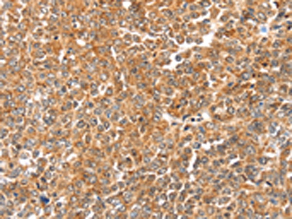 LOXL2 Antibody[43135]