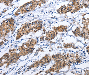 TNFRSF9 Antibody[36319]