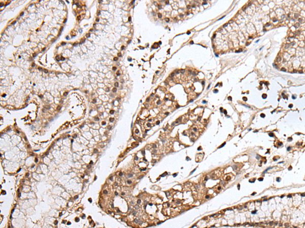 TAF1 Antibody[43706]