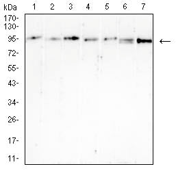 BRAF Mouse mAb[63162]