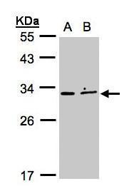 XRCC2 Antibody[35425]