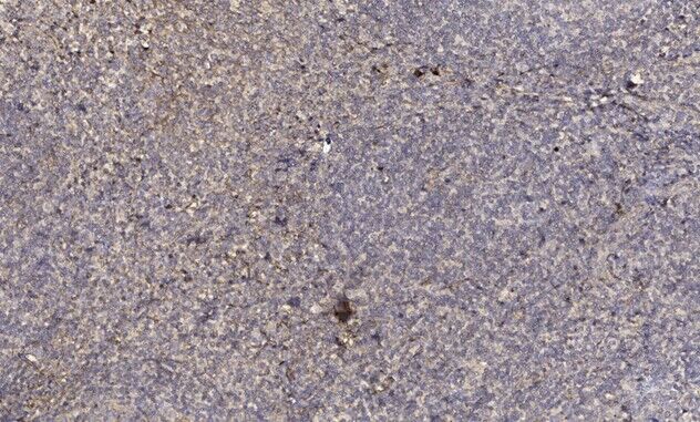 SP-B Polyclonal Antibody[41453