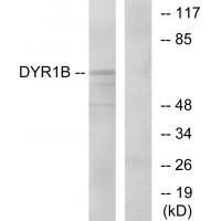 DYR1B Antibody[34135]