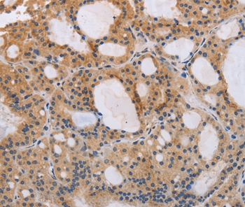 ITPR1 Antibody[37665]