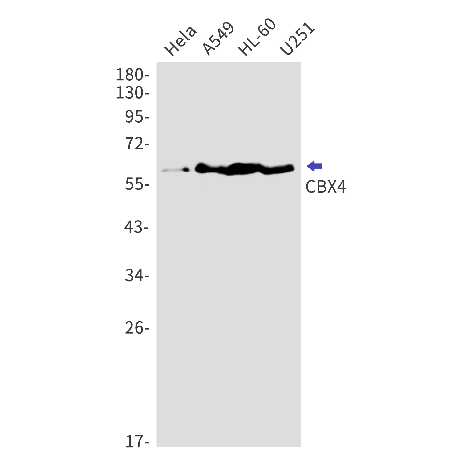 CBX4 Rabbit mAb[52685]