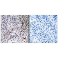 RAB11FIP3 Antibody[34950]