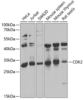 CDK2 Rabbit Polyclonal Antibod