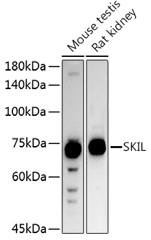 SKIL Rabbit Polyclonal Antibod