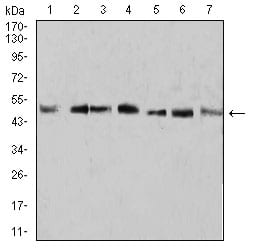 KLF2 Mouse mAb[63828]