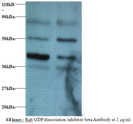 Rab GDP dissociation inhibitor