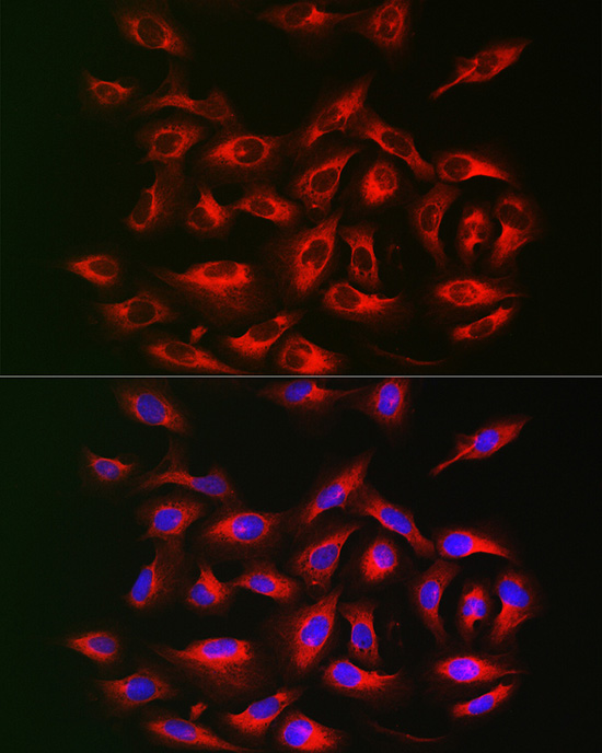 IRS2 Rabbit Polyclonal Antibod