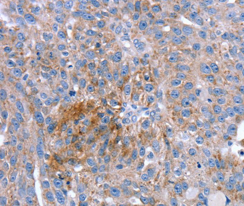 SPATA5L1 Antibody[40220]