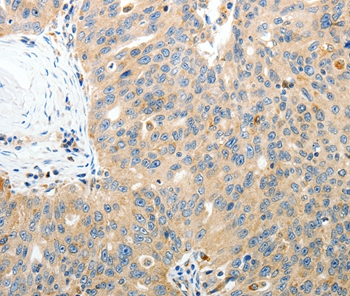 RAMP3 Antibody[35886]
