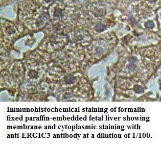 ERGIC3 Antibody[39500]