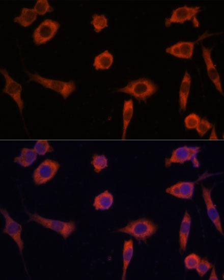STING / TMEM173 Rabbit Polyclo