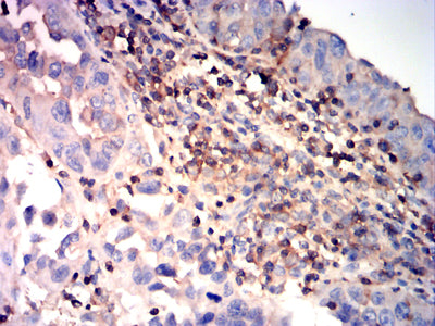 RHOA Mouse mAb[64181]