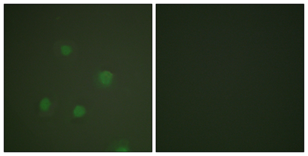 PR Polyclonal Antibody[44262]