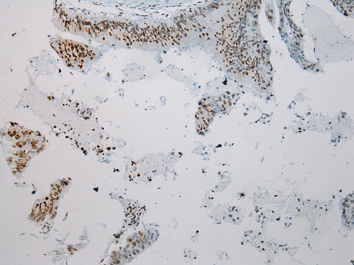 S1PR2 Antibody[40195]