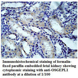 OSGEPL1 Antibody[39782]