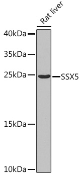 SSX5 Rabbit Polyclonal Antibod