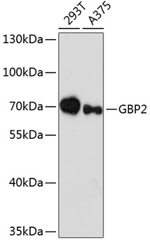 GBP2 Rabbit Polyclonal Antibod