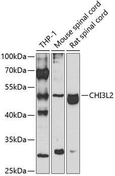 CHI3L2 Rabbit Polyclonal Antib