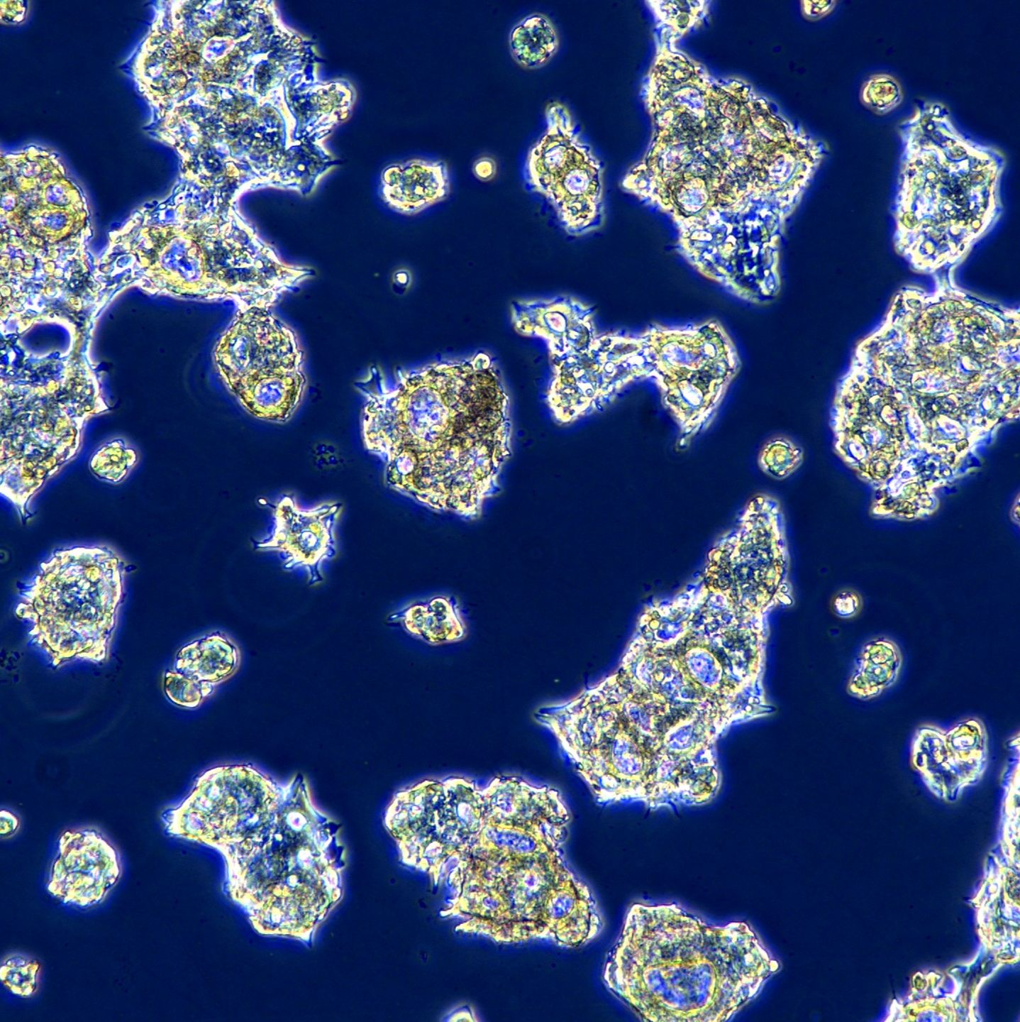 浙江（杭州）美森 人食管癌细胞OE-19(Luc1)现货