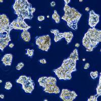 浙江（杭州）美森 人食管癌细胞OE-19(Luc1)现货