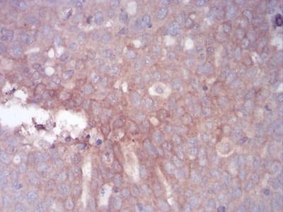 GLI1 Mouse mAb[63671]