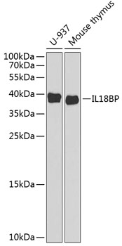 IL18BP antibody[38923]