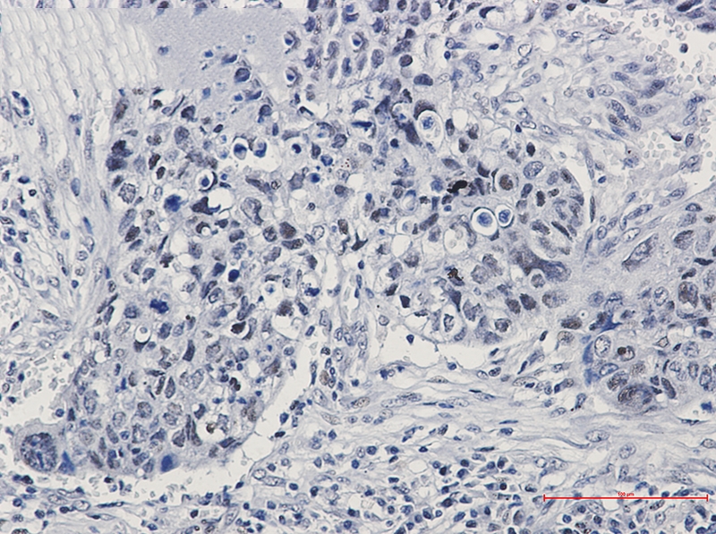 hnRNP K Rabbit mAb[52342]