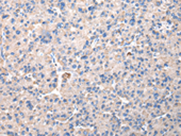 CHMP3 Antibody[42835]