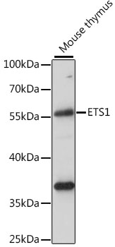 ETS1 Rabbit Polyclonal Antibod